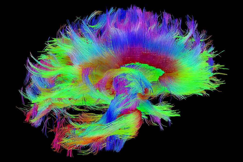 A colorful brain scan.